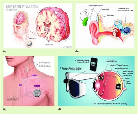 Applications Of Wpt System In Biomedical Implantable Medical Devices Download Scientific