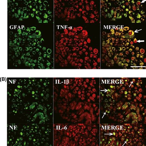 Doublestaining Immunofluorescence For Cytokines With Gfap And Nf In