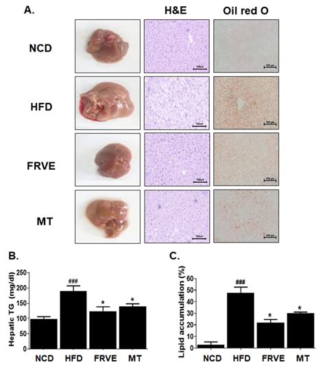 Effect Of Frve On Hepatic Steatosis And Lipid Accumulation In Download Scientific Diagram