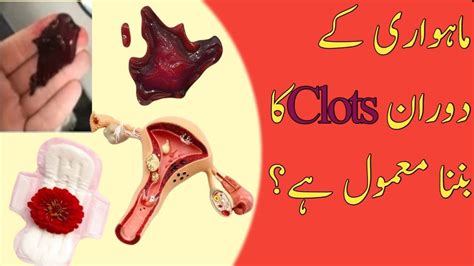 Periods Main Clots Kyon Aate Hai Period Main Clots Aana YouTube