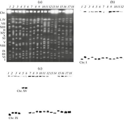 Pulsed Field Gel Electrophoresis Of Chromosomal Dna Of Saccharomyces