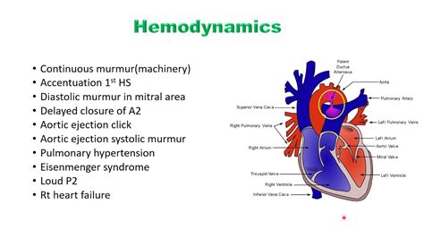 Patent Ductus Arteriosus Pda Youtube