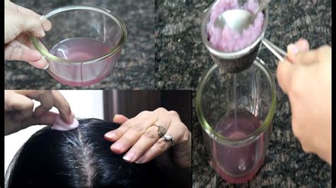 How To Use Onion Juice For Hair Regrowth Dandruff Hair Fall Control