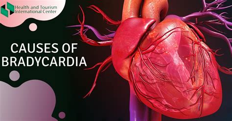 What causes bradycardia? - HTI CENTERS | Medical Tourism Center