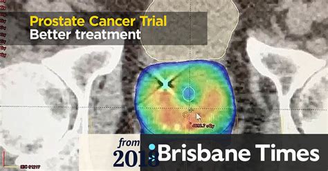 Video Prostate Cancer Trial Offers Hope