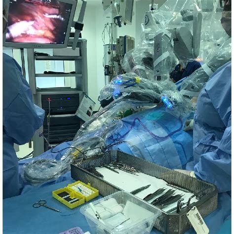 View Of The Robotic Arms During A Laparoscopic Fundoplication