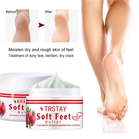 Cheap Foot Cream Antifreeze And Anti Cracking Cream Moisturizing