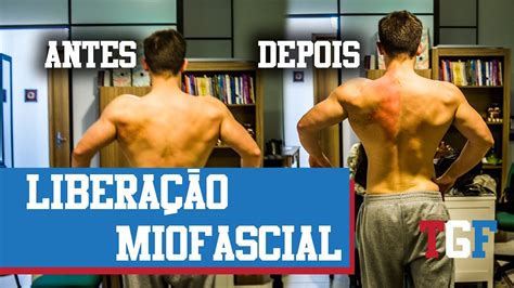 Liberação Miofascial YouTube