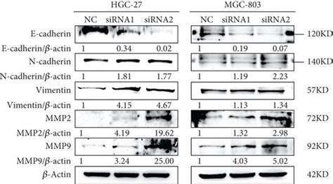 Cdr As Knockdown Promotes Migration And Invasion Of Gc Cells A B