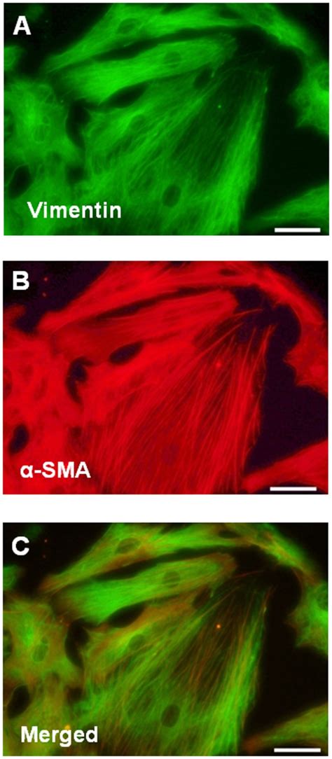 Vimentin Staining A α Smooth Muscle Actin α Sma Staining B And