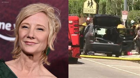 Anne Heche Seriously Injured After Car Slams Into Mar Vista Home