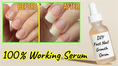 How To Make Nail Growth Serum At Home How To Grow Nails Nails Grow