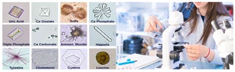 microscopic examination  urine medicoinfo