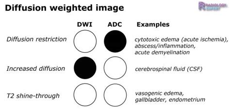 Mri Technique