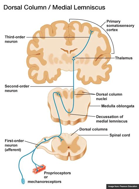 Differential Diagnosis of Weakness