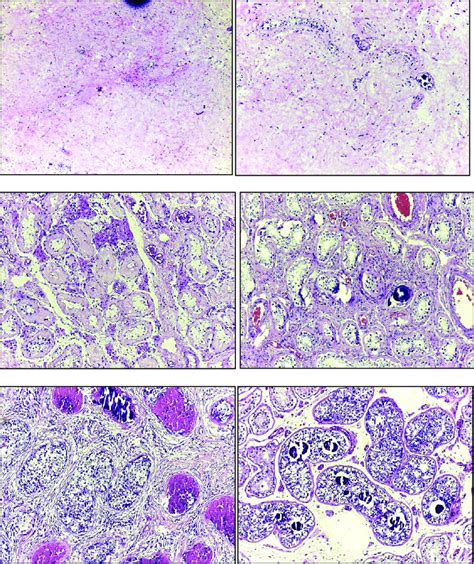 Microphotographs Of The Histomorphological Characteristics Of The