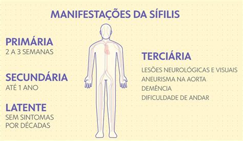 Total Imagen Segunda Fase De Sifilis Abzlocal Mx