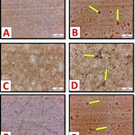 A Photomicrograph Of Caspase 3 Active Form Immunostained Sections Of