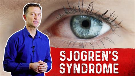 What Is Sjogren S Syndrome Understanding Sjogren S Syndrome Symptoms