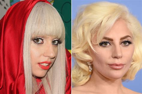 The changing face of Lady Gaga | Page Six