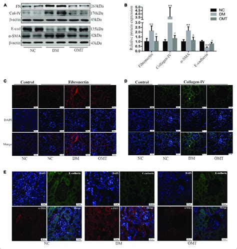 Effects Of Omt On The Expression Of Fibronectin Collagen Iv