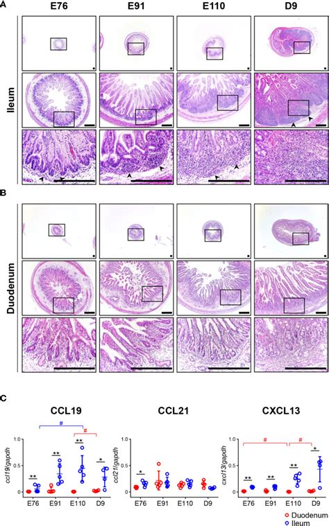 Frontiers Organogenesis Of Ileal Peyer S Patches Is Initiated