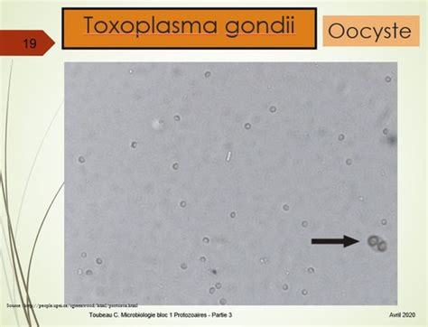 Toxoplasma Gondii Flashcards Quizlet