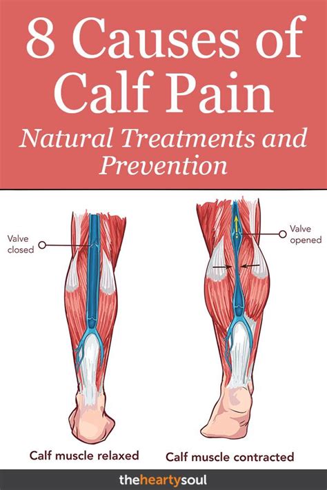 Leg Pain Calf Muscle
