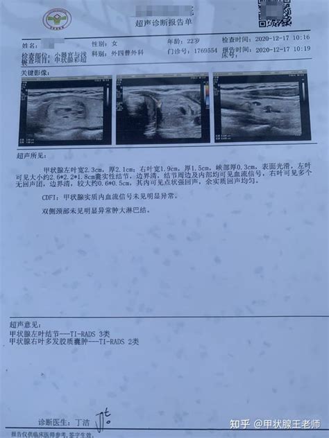 看不懂甲状腺b超报告？看完本文，你自己也能判断良恶性！ 知乎