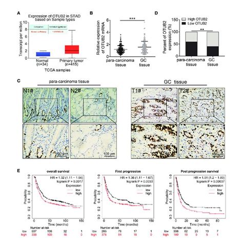 Otubain 2 OTUB2 Is Highly Expressed In Gastric Cancer GC Tissues