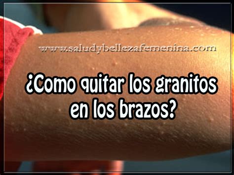 Como Quitar Los Granitos En Los Brazos Salud Y Belleza