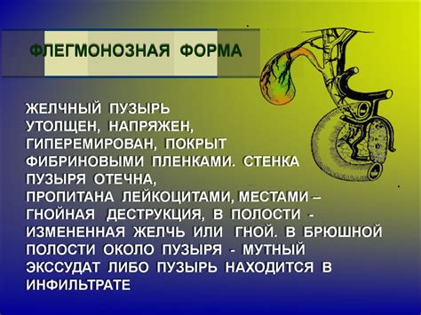 Острый холецистит - презентация онлайн