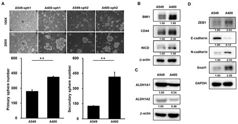 Cancer Stem Cell Csc Activity And Epithelial To Mesenchymal