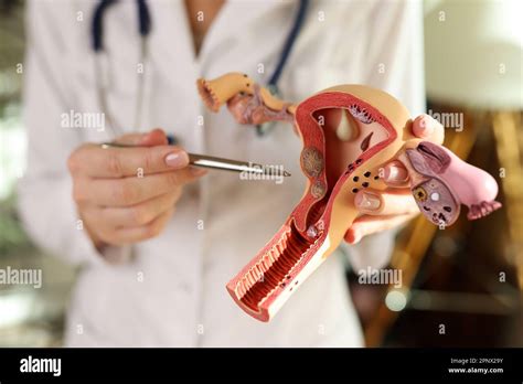 Gynecologist Points Pen To Anatomical Model Of Uterus In Hand