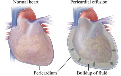 Pathophysiological Process And Clinical Presentation Correct Diagnosis