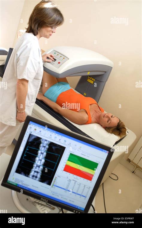 A Doctor Uses A Bone Densitometer To Measure The Optical Density Of The