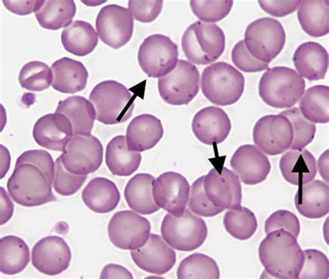 Blood Parasites Flashcards Quizlet