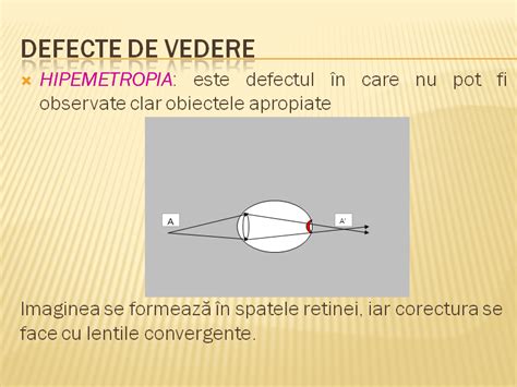 FIZICA INTERACTIVA Proiect Didactic Ochiul Ochelarii Lupa