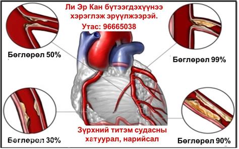 Цус шингэлж судас цэвэрлэгч Ли Эр Кан