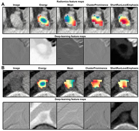 Visualization Of Hand Crafted Radiomic Features And Deep Features A Download Scientific