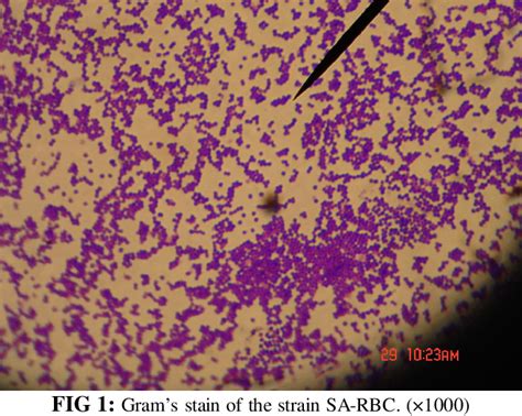 Staphylococcus Aureus Gram Stain 100x