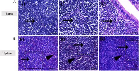 Photomicrograph Of Bursa A And Spleen B Of Broiler Chickens