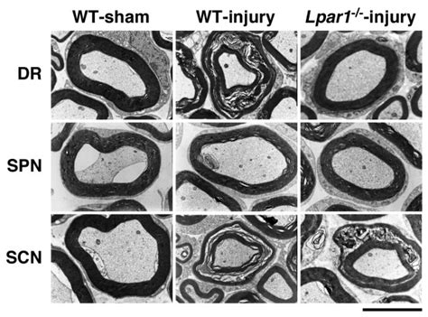 Analysis of LPA1 receptor-dependent and -independent A-fiber ...