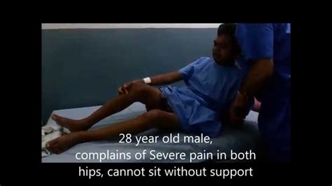 Total Hip Replacement By Dr Varun Chouhan Youtube