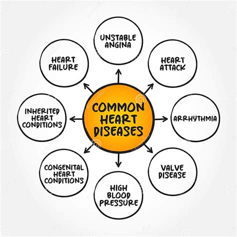 Common Heart Diseases Mind Map Text Concept For Presentations And Reports Stock Image Image Of