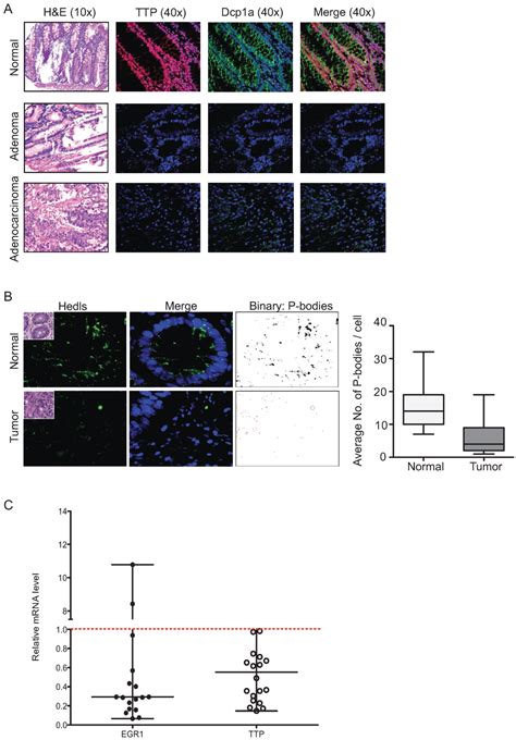 Biomolecules | Special Issue : RNA-Binding Proteins—Structure, Function ...