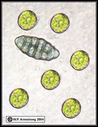 Foliose Lichen Under Microscope