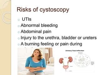 Cystoscopy | PPT