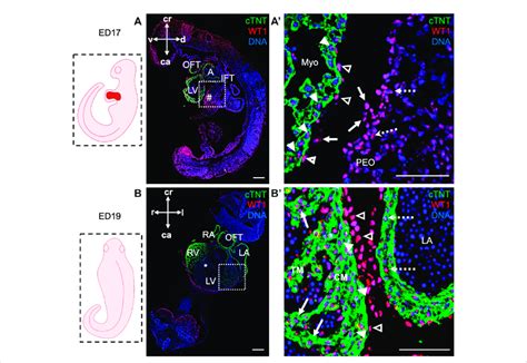 Wt1 Expression In Proepicardium And Epicardium Of Ed17 And Ed19 Porcine Download Scientific