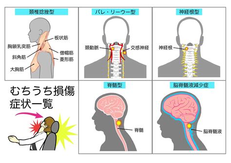 交通事故などのむち打ち症の痛みでお困りの方 あなたの体のお悩みを解決します。当院独自の体の見方で原因を分析・解決します。 鍼灸接骨院て